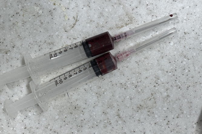 두개의 주사기안에 채혈한 피가 담겨있는 사진