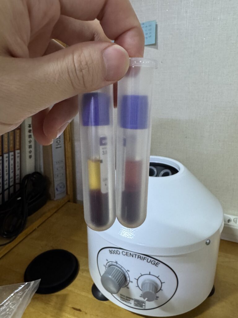 원심분리 종료 후 혈장 사진