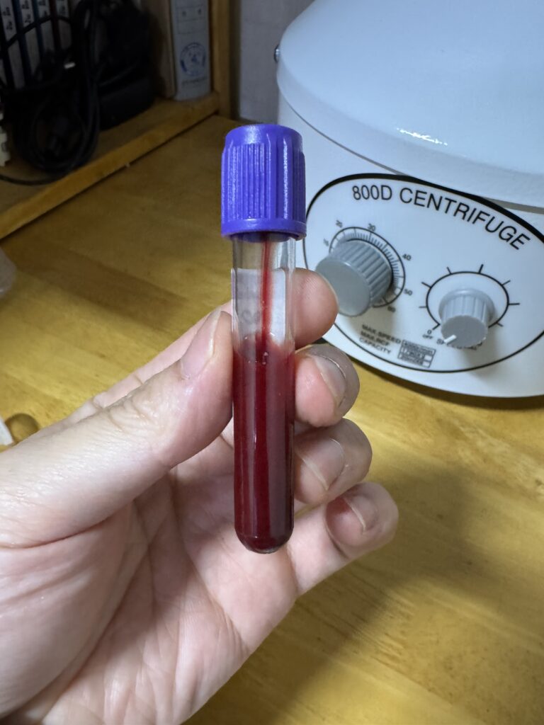 혈장 적혈구층 섞임